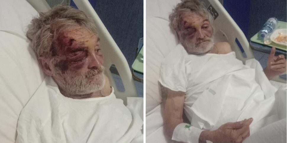 Clochard brutally attacked during the night in Cosenza, city and associations outraged: "An attack on human dignity"