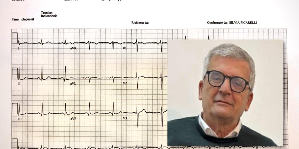 Healthcare, revolution in the Greek Sila: the first remote electrocardiogram in Longobucco