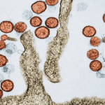 Hantavirus, test on an Argentine tourist hospitalized for pneumonia in Messina: sample sent to Spallanzani