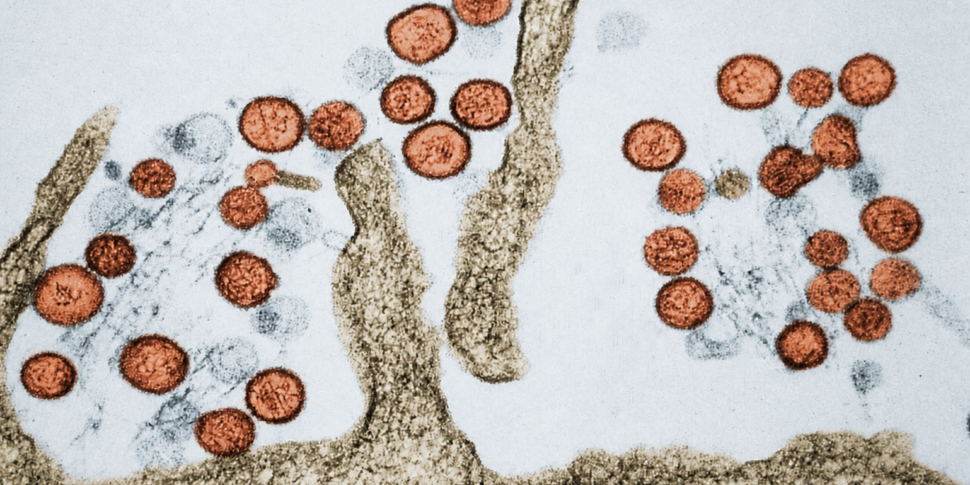 Hantavirus, test on an Argentine tourist hospitalized for pneumonia in Messina: sample sent to Spallanzani