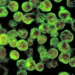 Shock in Louisiana, 8-year-old girl dies from a "brain-eating" amoeba: that's what it is