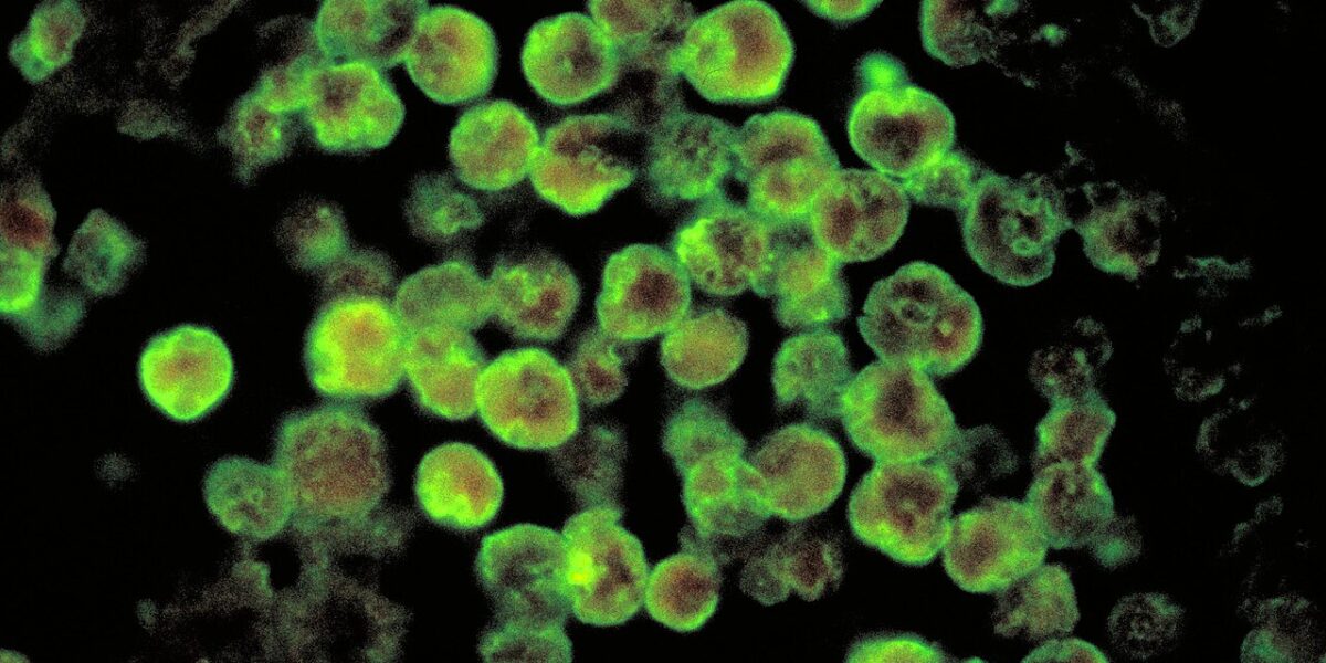 Shock in Louisiana, 8-year-old girl dies from a "brain-eating" amoeba: that's what it is